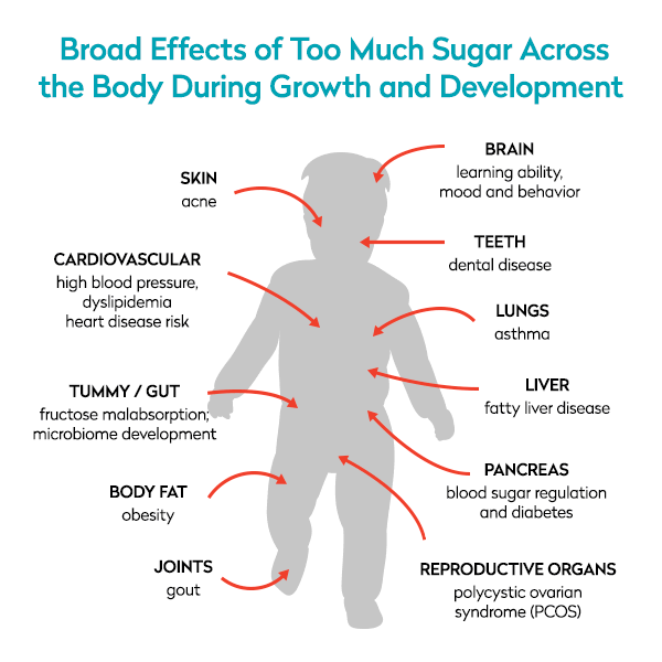 Broad effects of too much sugar across the body during growth and development of a kid.